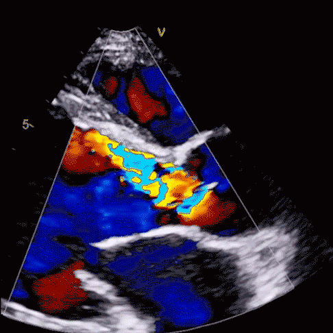 Echo image